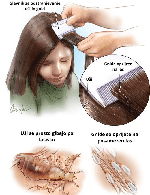 NAGLAVNE UŠI V ŠOLI IN  VRTCU